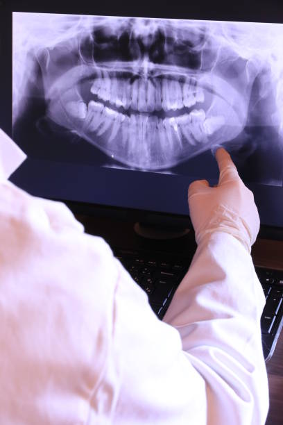 Best Urgent Care for Lost Fillings or Crowns in Cutlerville, MI