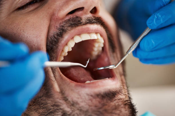 Best Emergency Treatment for Dental Infections or Abscesses in Cutlerville, MI